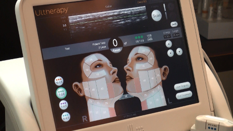Alat Ultherapy. (Sumber gambar: ultherapy.com)