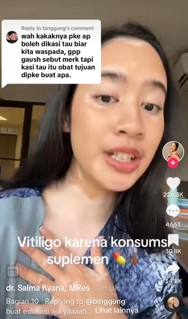Salma Kyana yang mengalami vitiligo. (Sumber gambar : tangkapan layar TikTok @salmakyn)