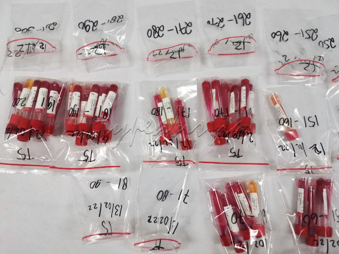 Sampel cairan dari para pasien COVID-19 di Wisma Atlit, Jakarta Pusat. Untuk uji lab, guna menentukan apakah hasilnya negatif atau masih positif corona.<br />
Sehingga pasien bisa dinyatakan sembuh dan diperbolehkan untuk pulang jika hasil test negatif, atau masih harus menjalani rawat inap jika hasil test masih menunjukan positif.